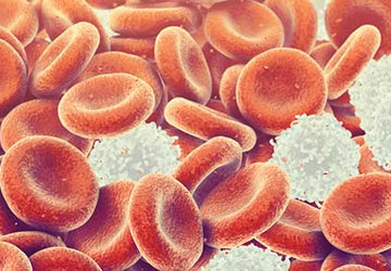 What Does A High Number of Luekocytes Mean?