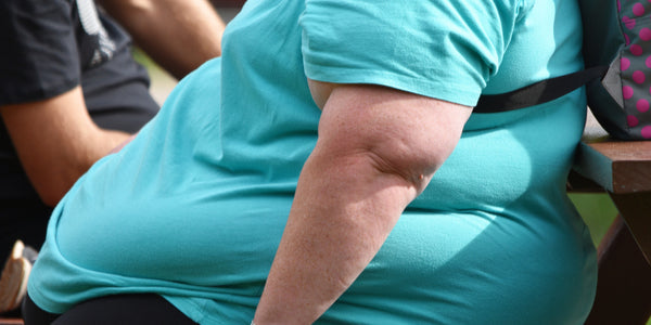 Complications of Obesity Include Heart Disease and Arthritis